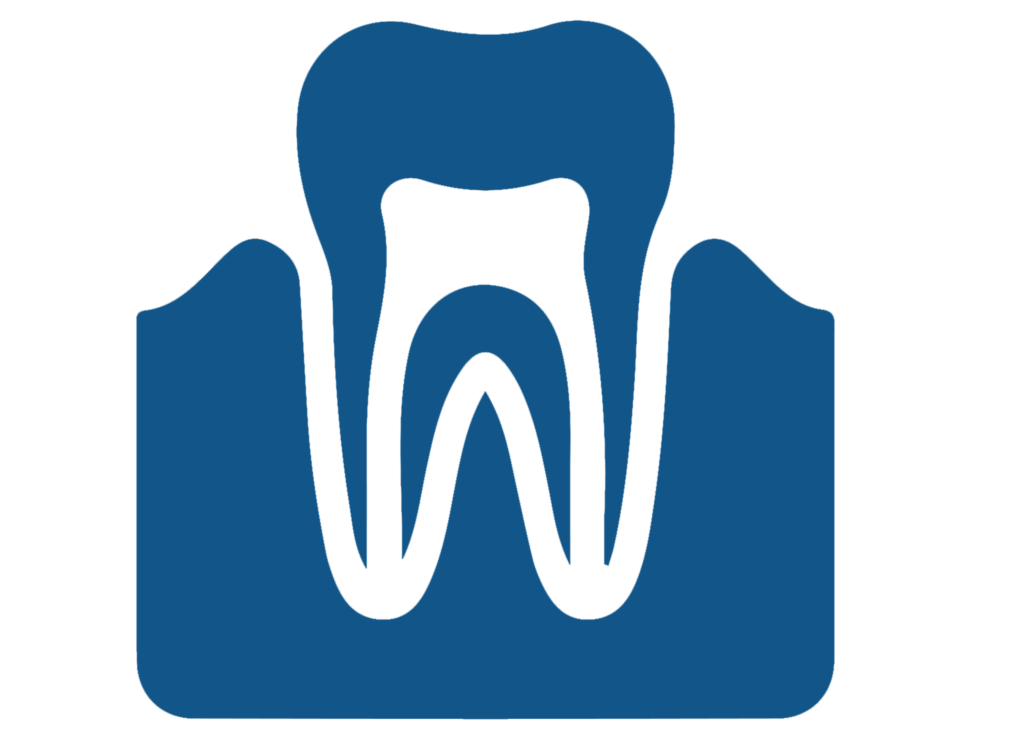 Root Canal2 Root Canal2