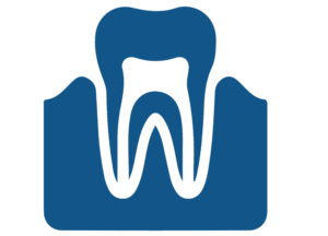 Root Canal2 Root Canal2